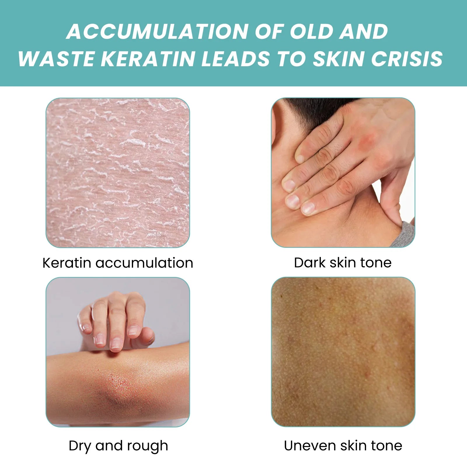 A2cd85f4e55b142f8a2d0122aece226942