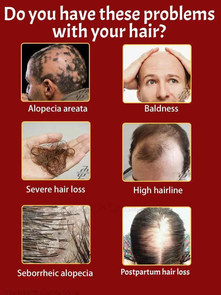 ZKRICARO 0fficial genuine, high quality hair growth essence 0il, scalp care, make hair grow thicker, no more baIIdness