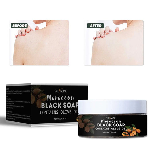 S4db5bcecdece48a1a5803adebd44ae09m