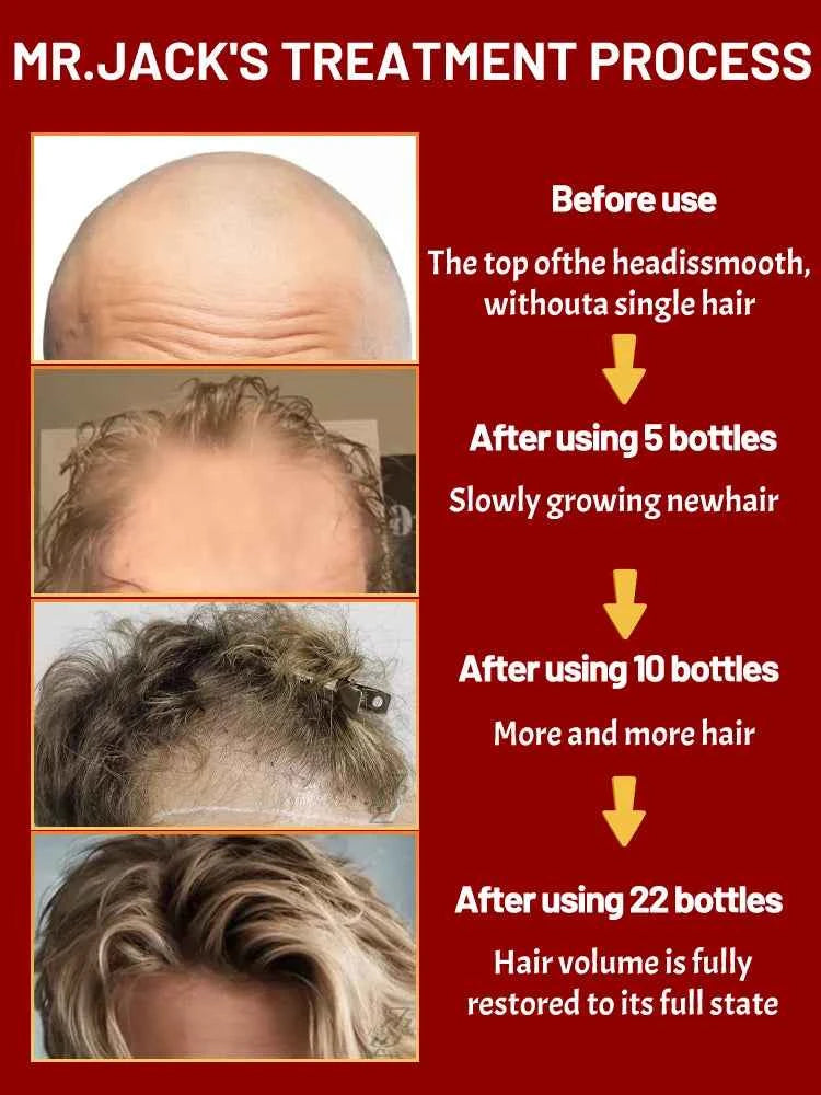 ZKRICARO 0fficial genuine, high quality hair growth essence 0il, scalp care, make hair grow thicker, no more baIIdness